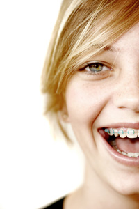 closeup of girl with braces